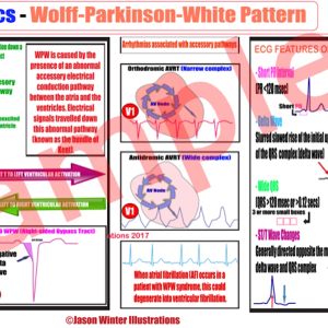 ecg pdf books free download