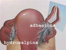 ap1.2.13 repro