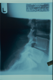Bone 2010