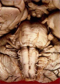 Cranial Nerves and Tracts 2010
